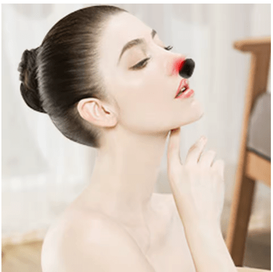 Appareil de thérapie nasale - Douce Peau